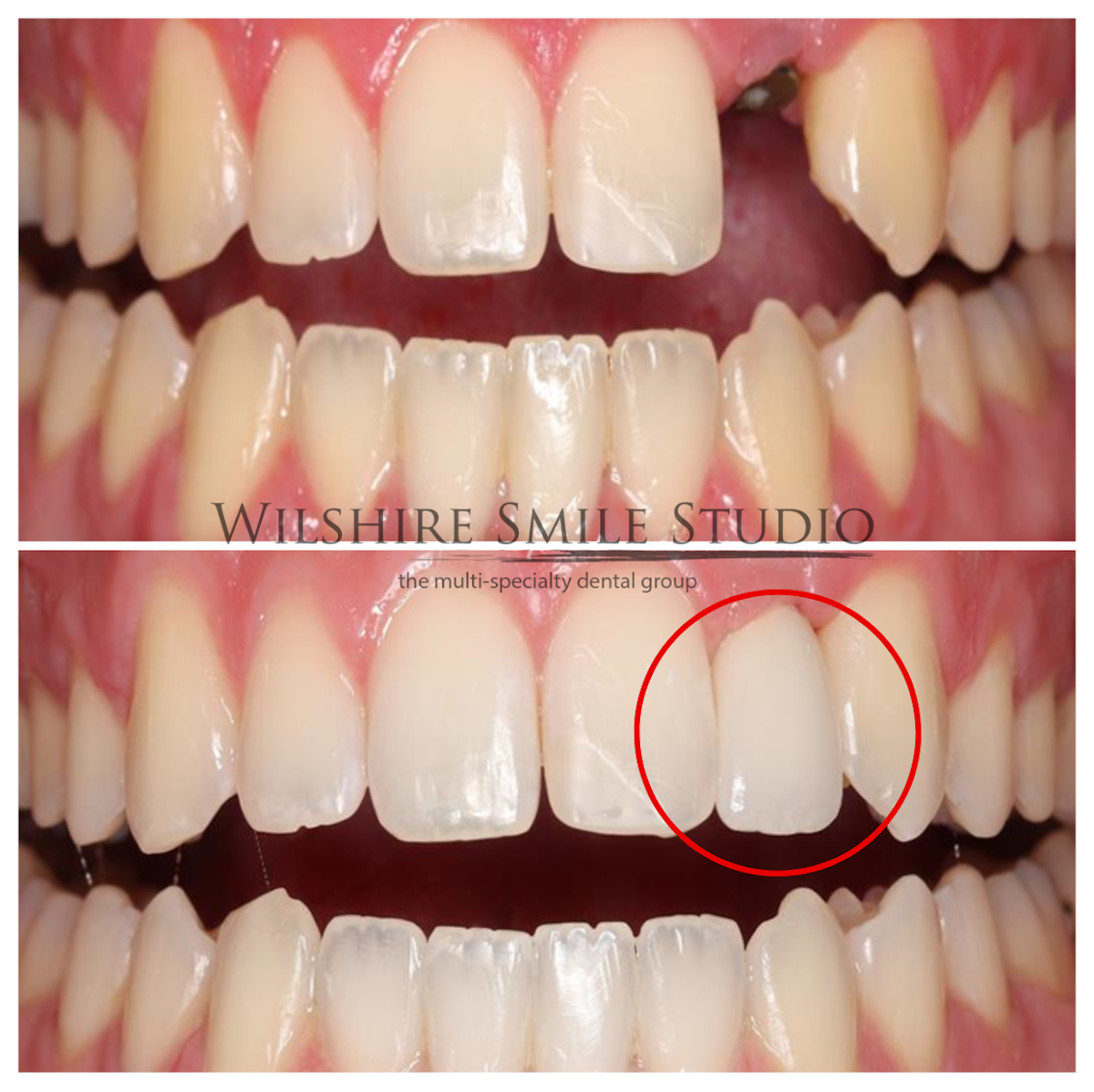 Los Angeles Oral Surgeon - Dr. Nariman Saadat - Oral Surgery Doctor photo 5