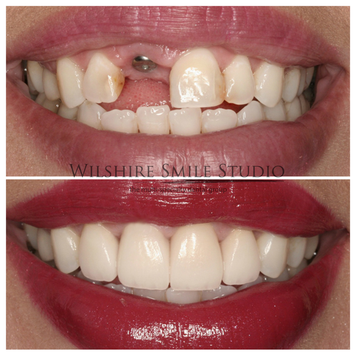 Los Angeles Oral Surgeon - Dr. Nariman Saadat - Oral Surgery Doctor photo 6