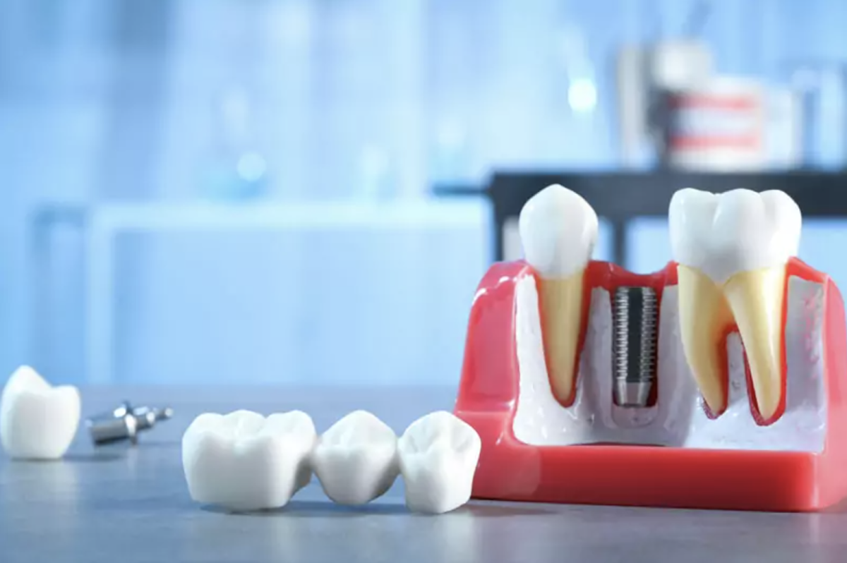 I-implant Dentistry photo 2