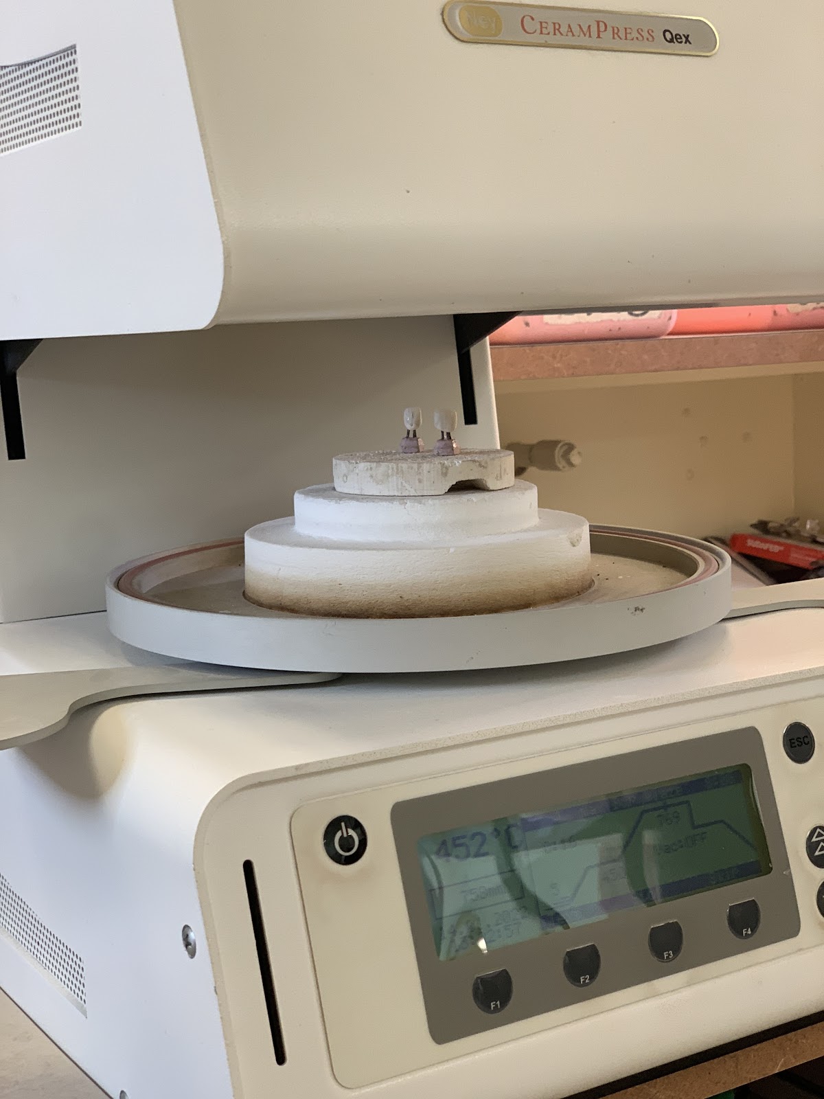 Finesse Dental Lab photo 2