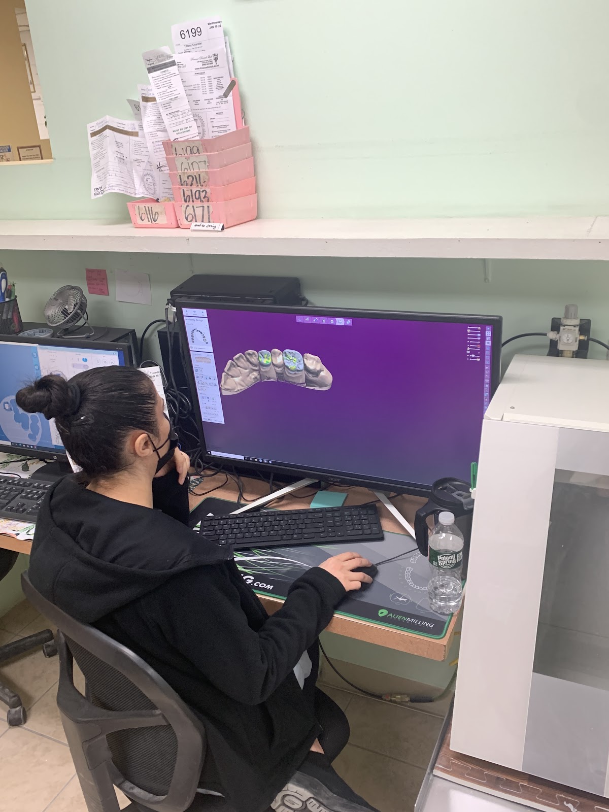Finesse Dental Lab photo 3