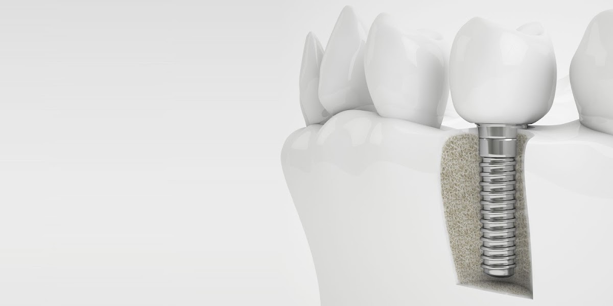Paradise Dental Associates photo 5