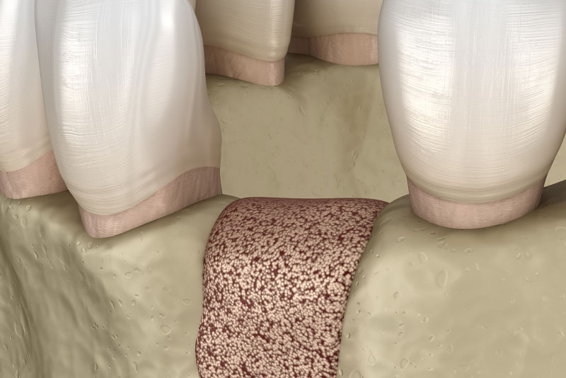 Paradise Dental Associates photo 6