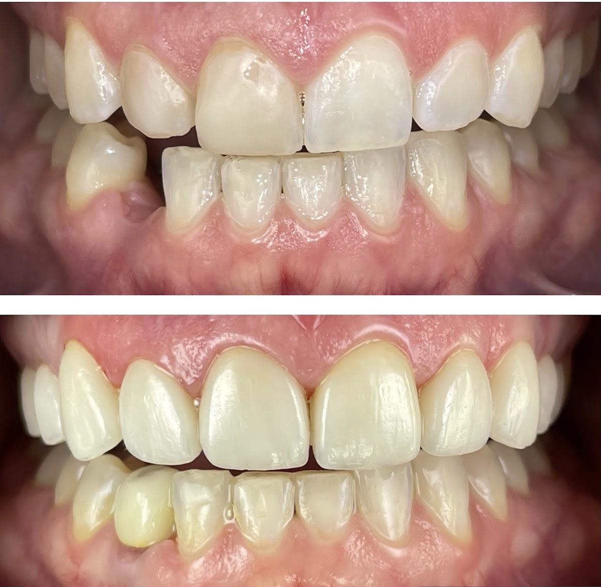 Kauai Dental Studio - Drs. Paul Yoo, Miriam Gonzalez & Joyjoy Fries photo 4