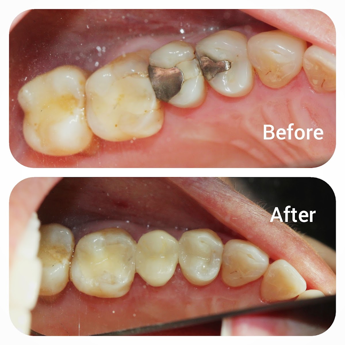 Galvez Dental photo 1