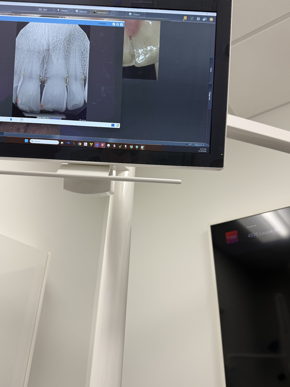 Nkc Dental photo 3