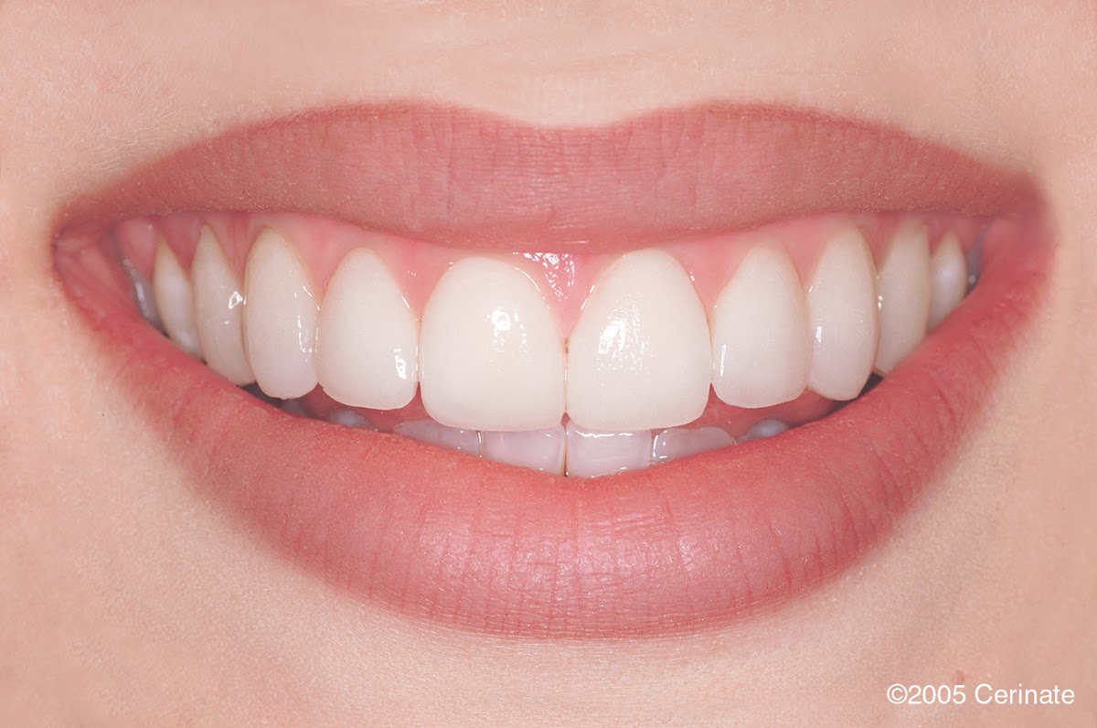 Healthy Smiles Dental Care photo 4