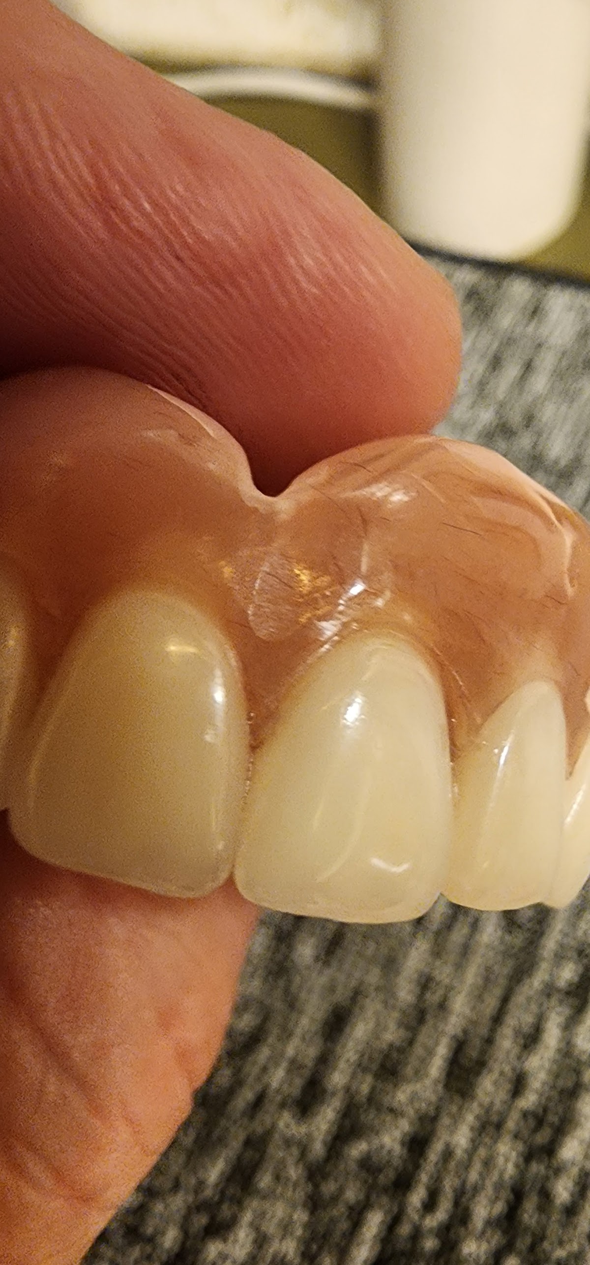 Mcintyre Dentures and Extractions photo 4