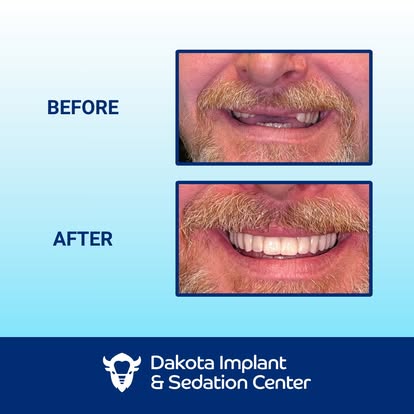 Dakota Implant & Sedation Center photo 6