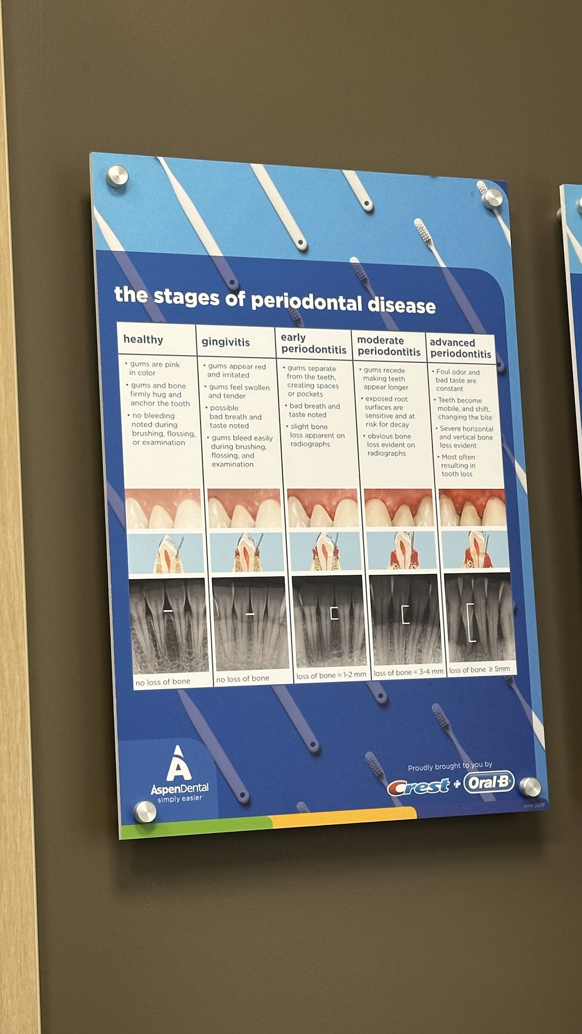 Aspen Dental - Gurnee photo 4