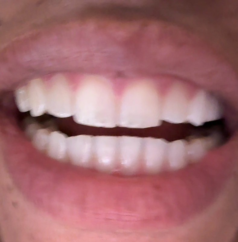 Aspen Dental - Gurnee photo 6
