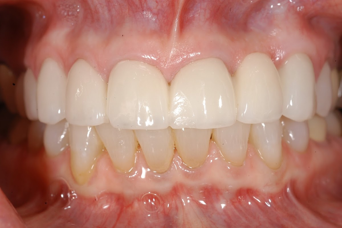 Treasure Coast Dental - Dr. Rachel S. Squier photo 4