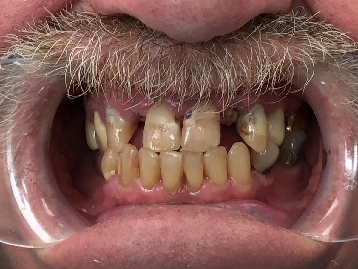 Selah Creek Dental photo 6