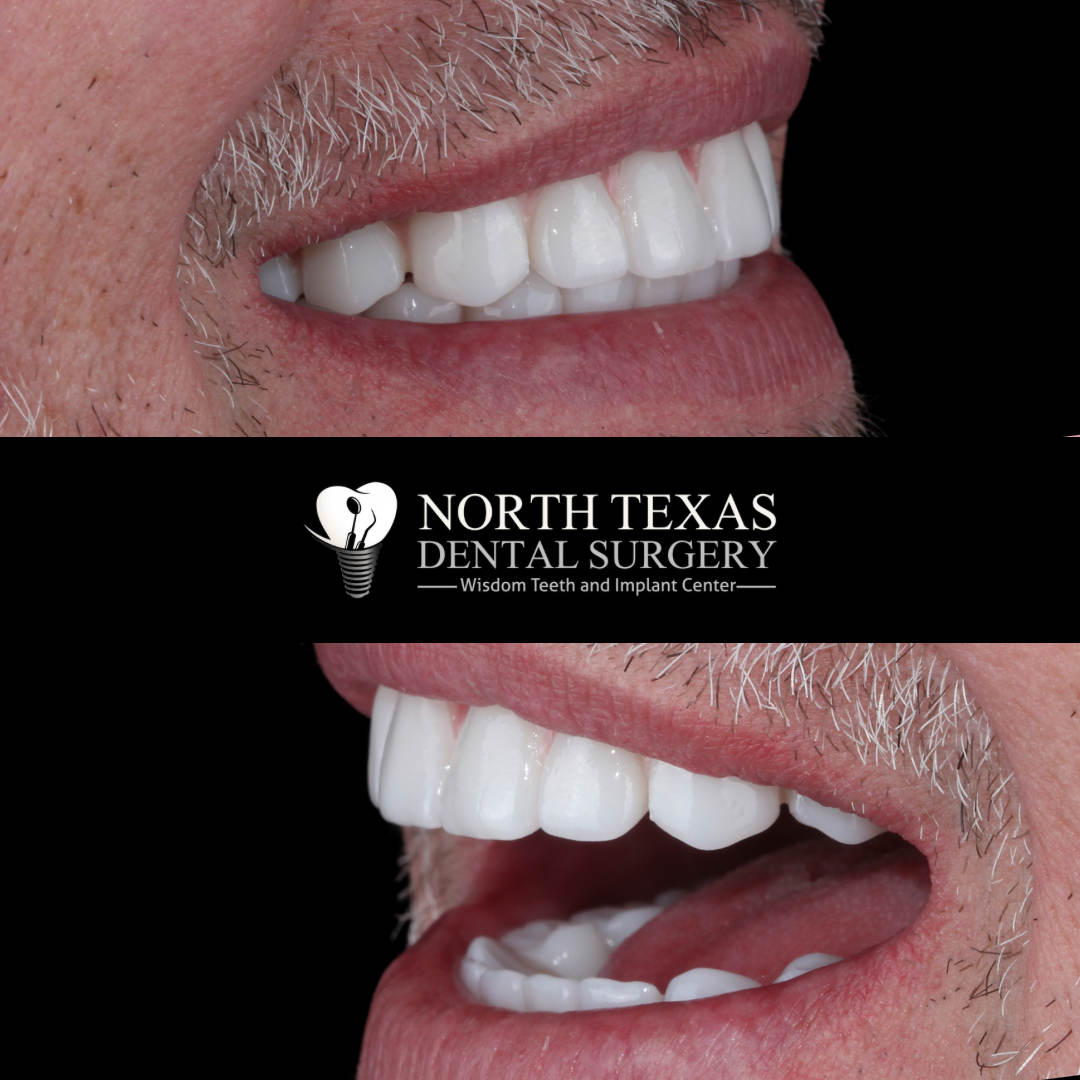 North Texas Dental Surgery photo 1