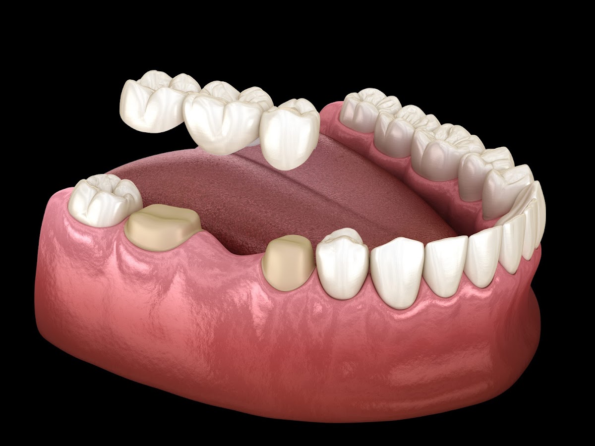 Crescent Family and Cosmetic Dentistry photo 2