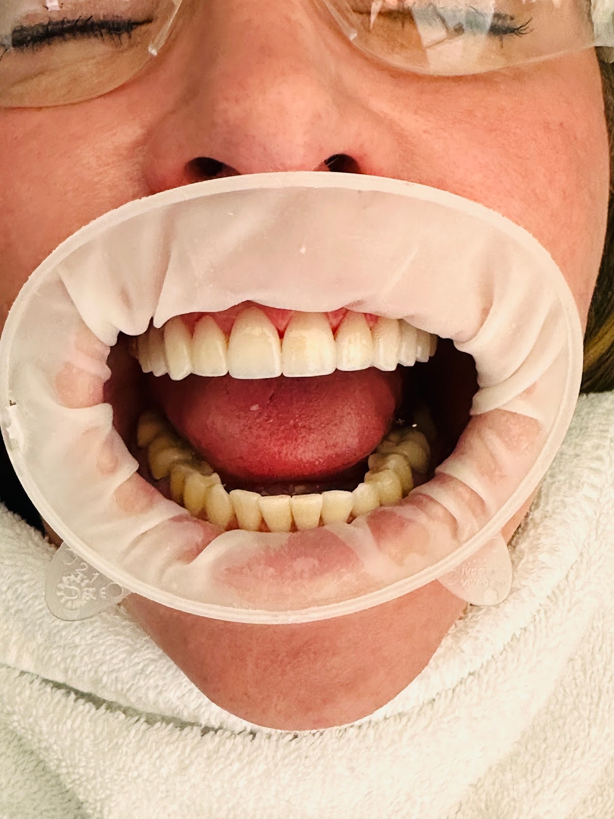Creating Beautiful Smiles: Kevin V. Diep, DMD photo 6