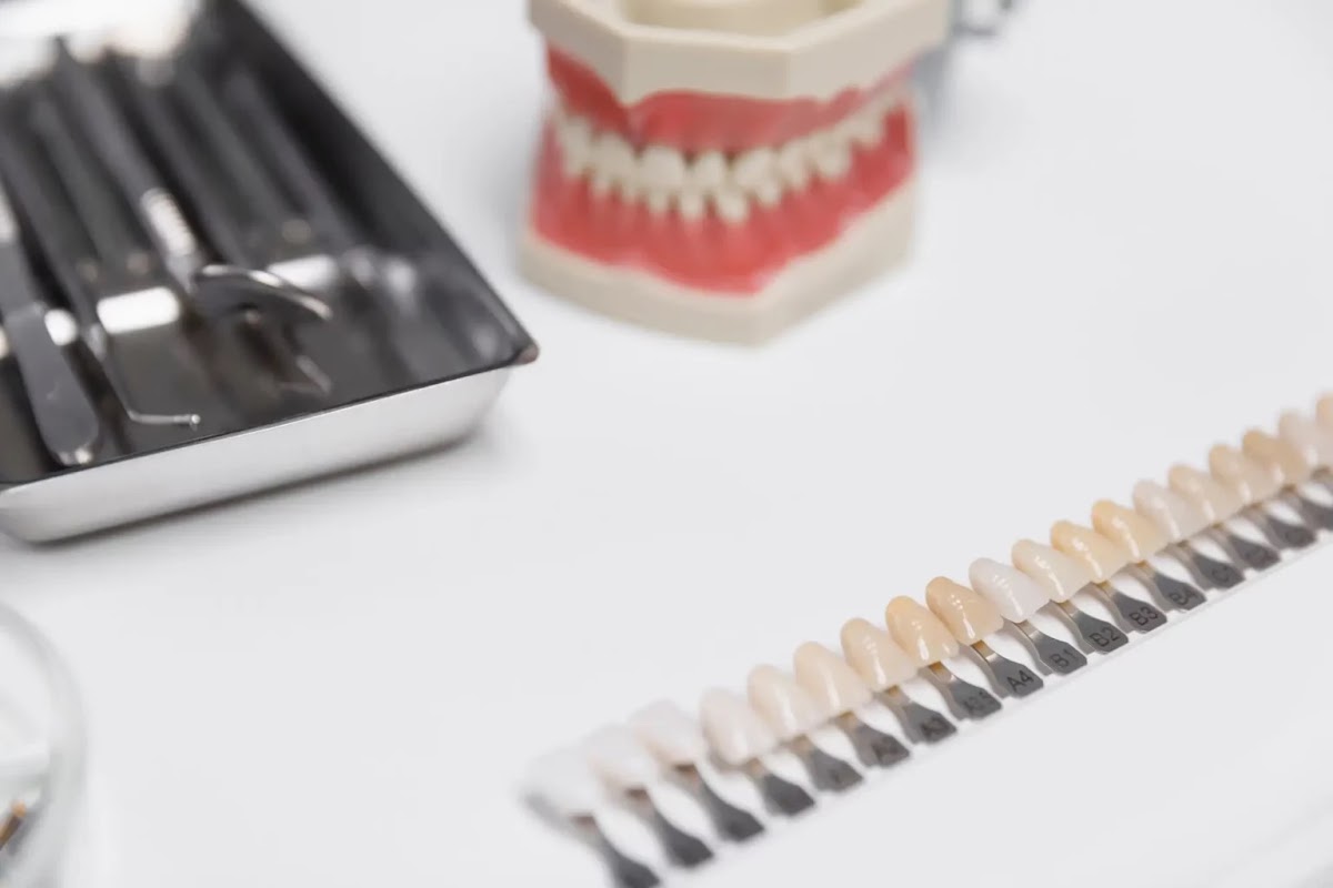 Affordable Dental Veneers Clifton photo 1