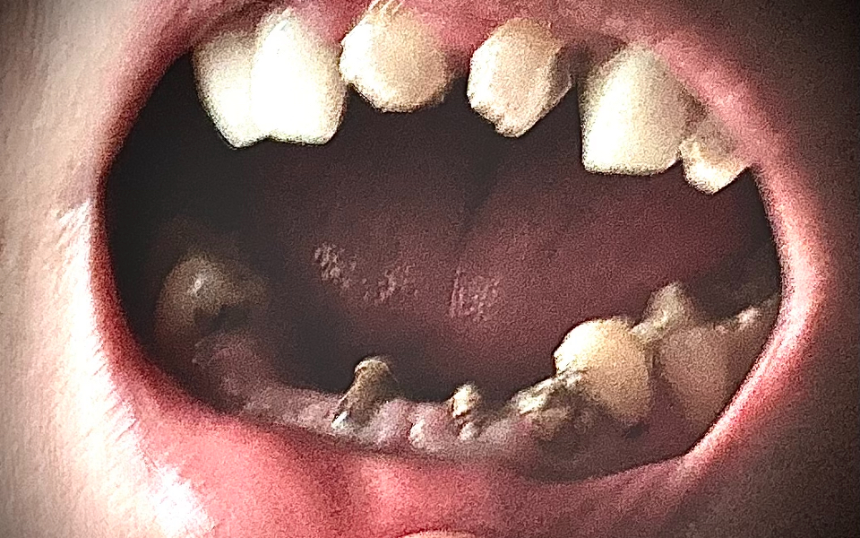 Affordable Dentures & Implants - Warren photo 3