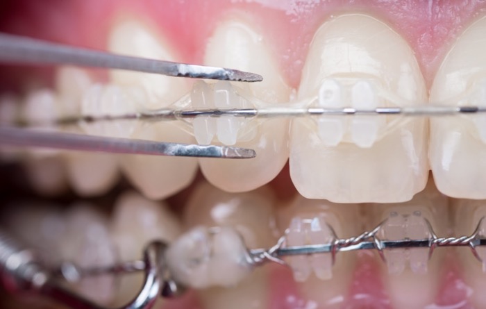 Oyster Point Dental photo 1