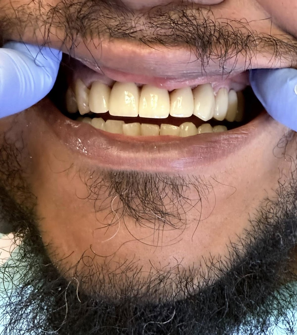 Smile City - St. Cloud photo 3