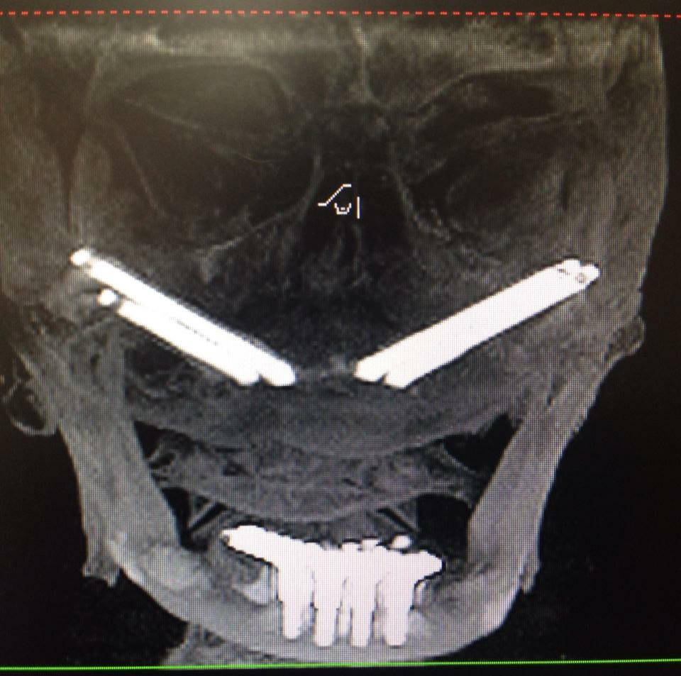 Desert Ridge Oral Surgery Institute photo 4