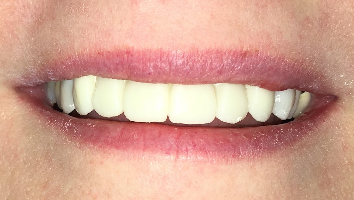 Turlock Dentistry and Implants photo 1