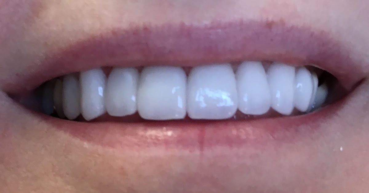 Turlock Dentistry and Implants photo 2