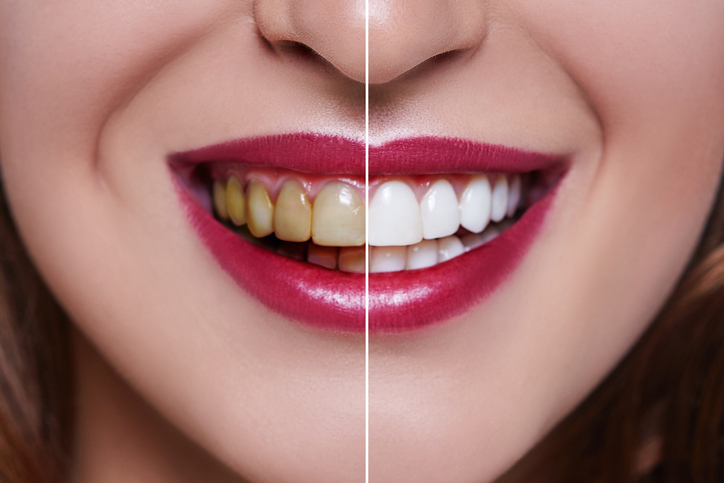 Auburn Lakes Periodontics & Dental Implants photo 3