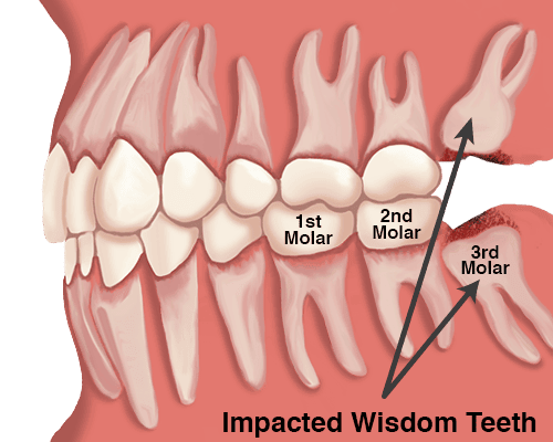 Blue Wave Implants and Oral Surgery photo 3