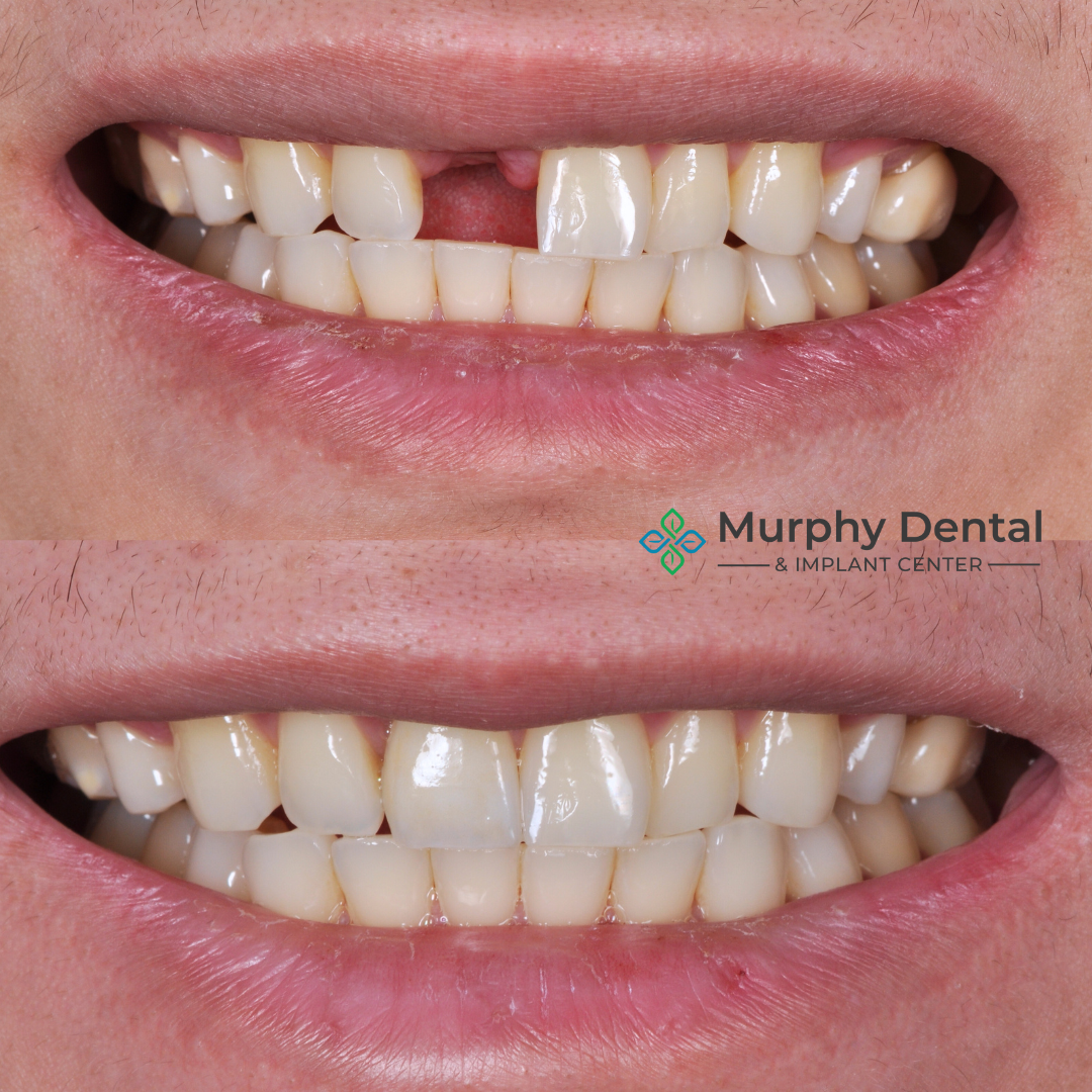 Murphy Dental And Implant Center photo 2