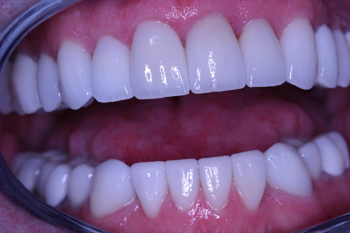 Hamblin Dental Implant & Aesthetic photo 4