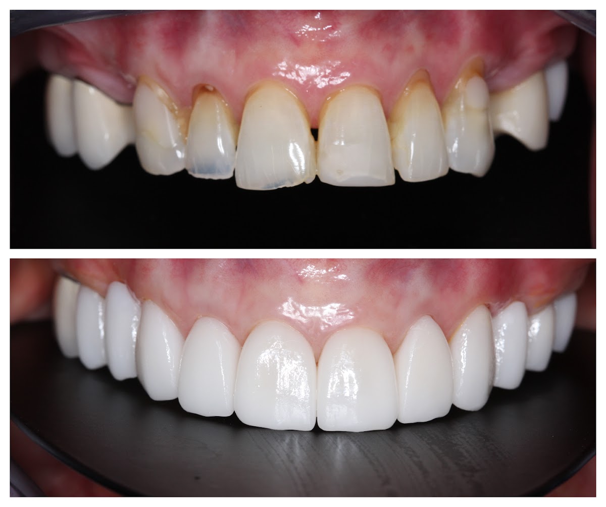 Griffis Southern Dental Care photo 1