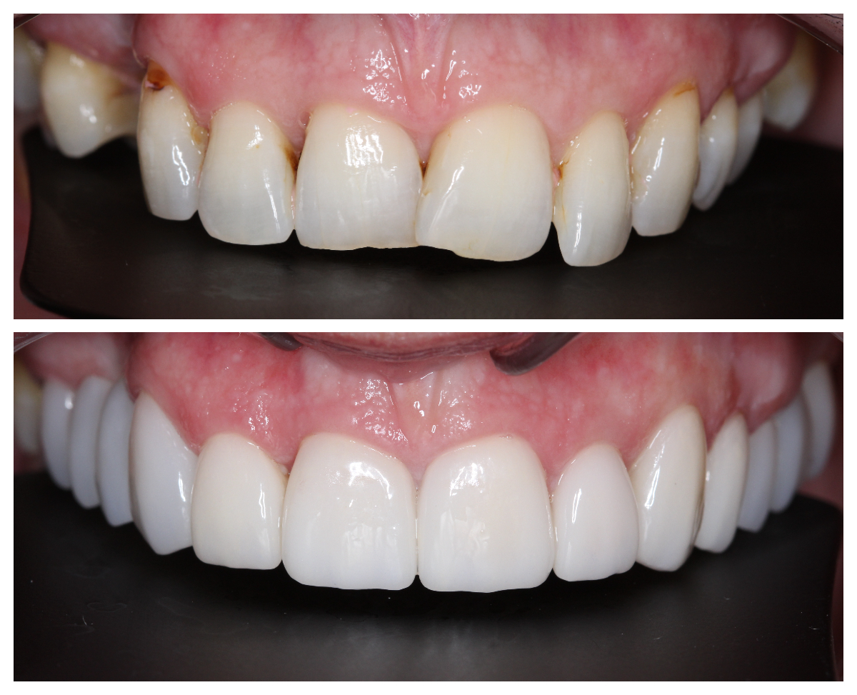 Griffis Southern Dental Care photo 5