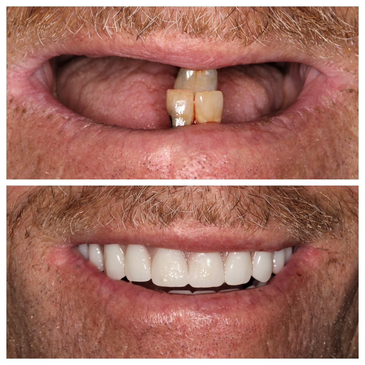 Griffis Southern Dental Care photo 6