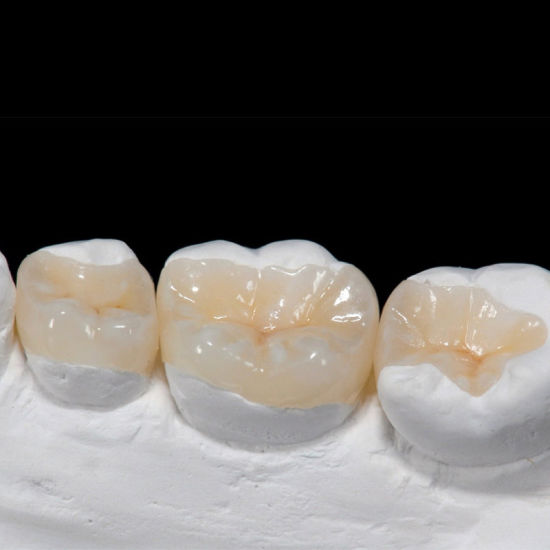 Uptown Dental Lab- All on 4 Dental Implants Houston | Dental Labs in Houston Texas photo 3