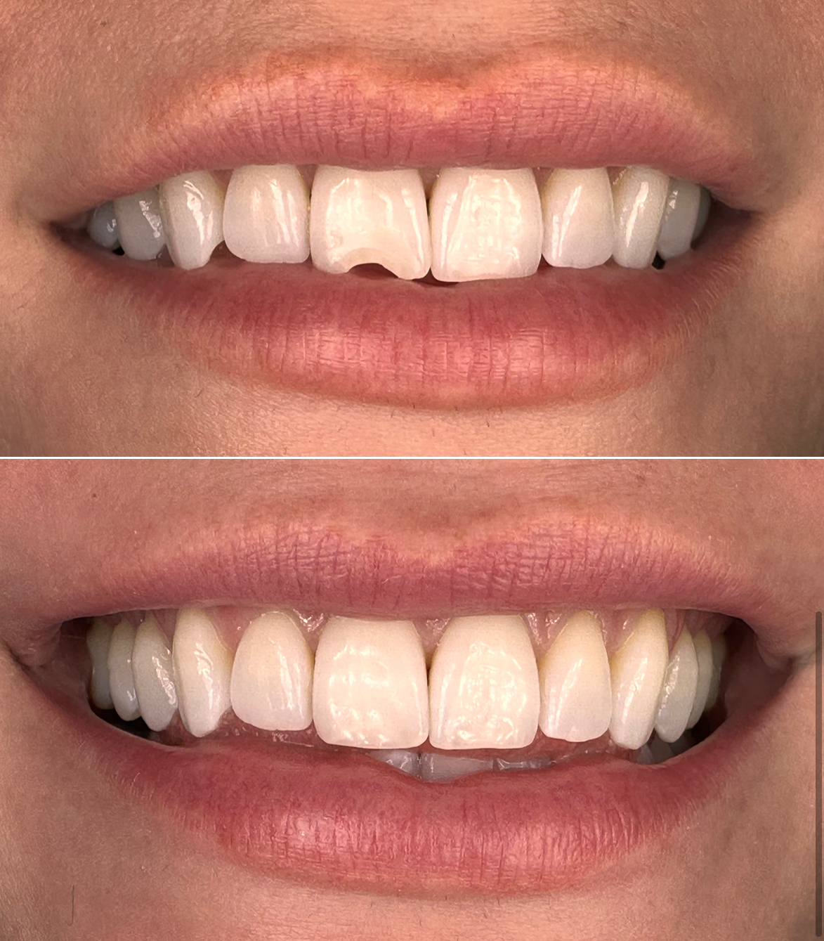Centerport Cosmetic & Implant Dentistry photo 2