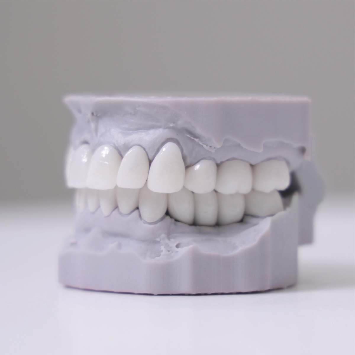 Ora 4x Full Arch Implant Center photo 4