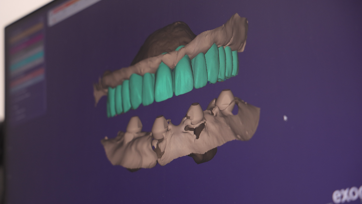 Ora 4x Full Arch Implant Center photo 5