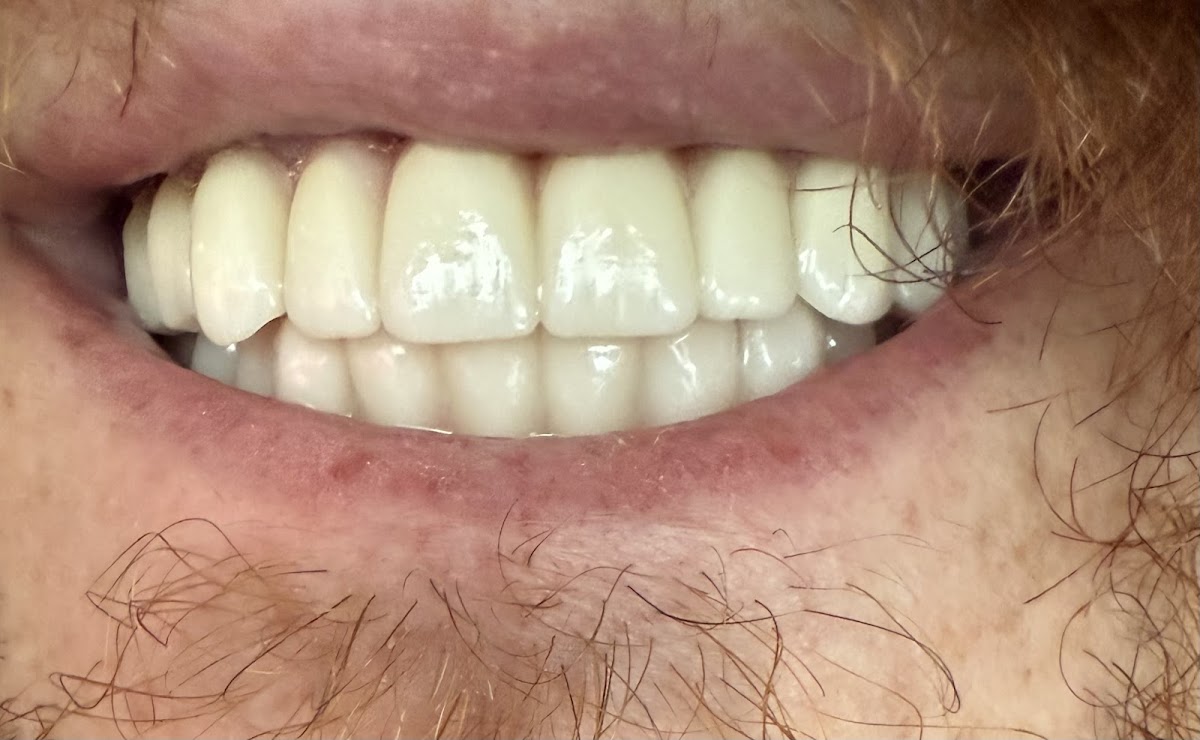 Ora 4x Full Arch Implant Center photo 6