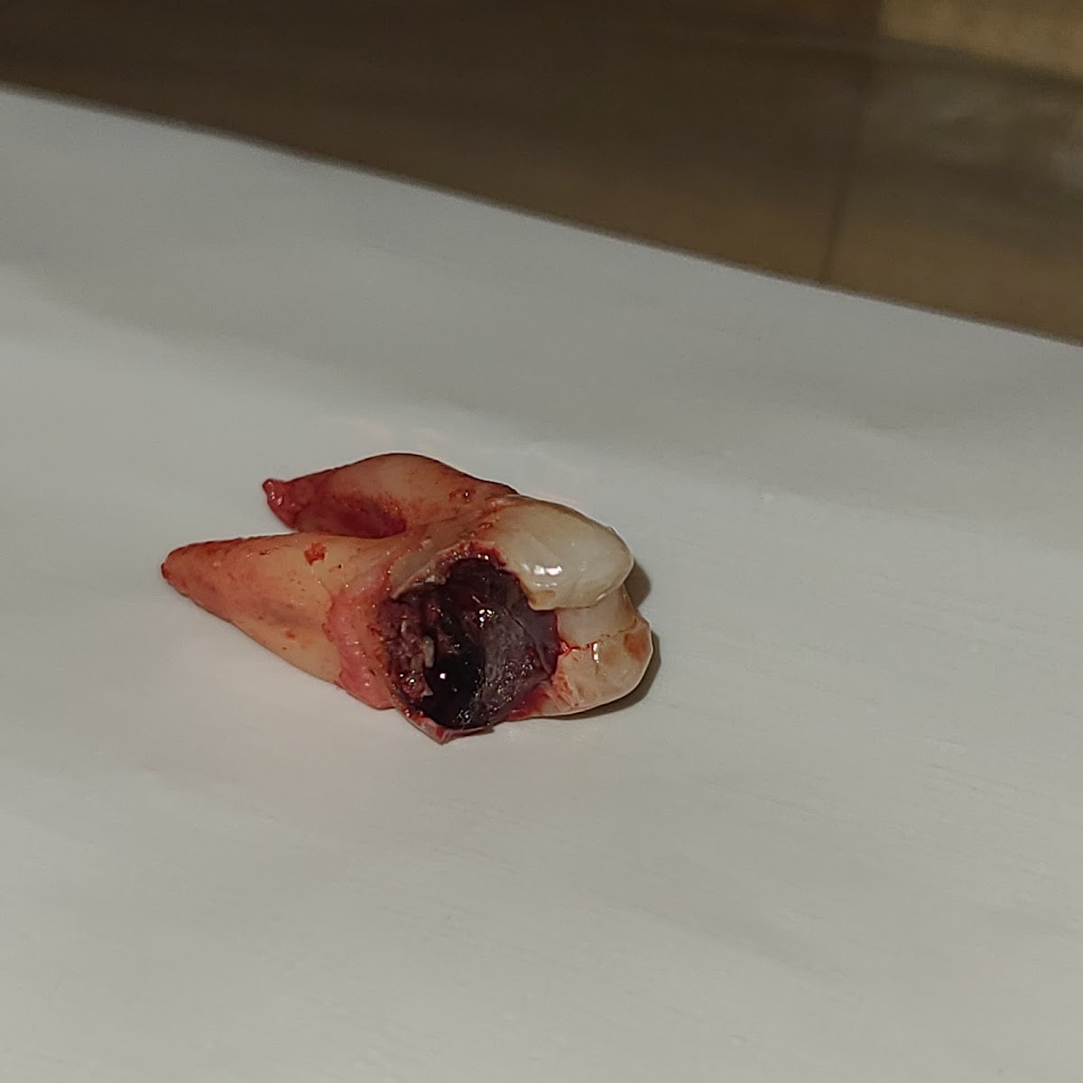 Affordable Dentures & Implants - Wichita photo 4