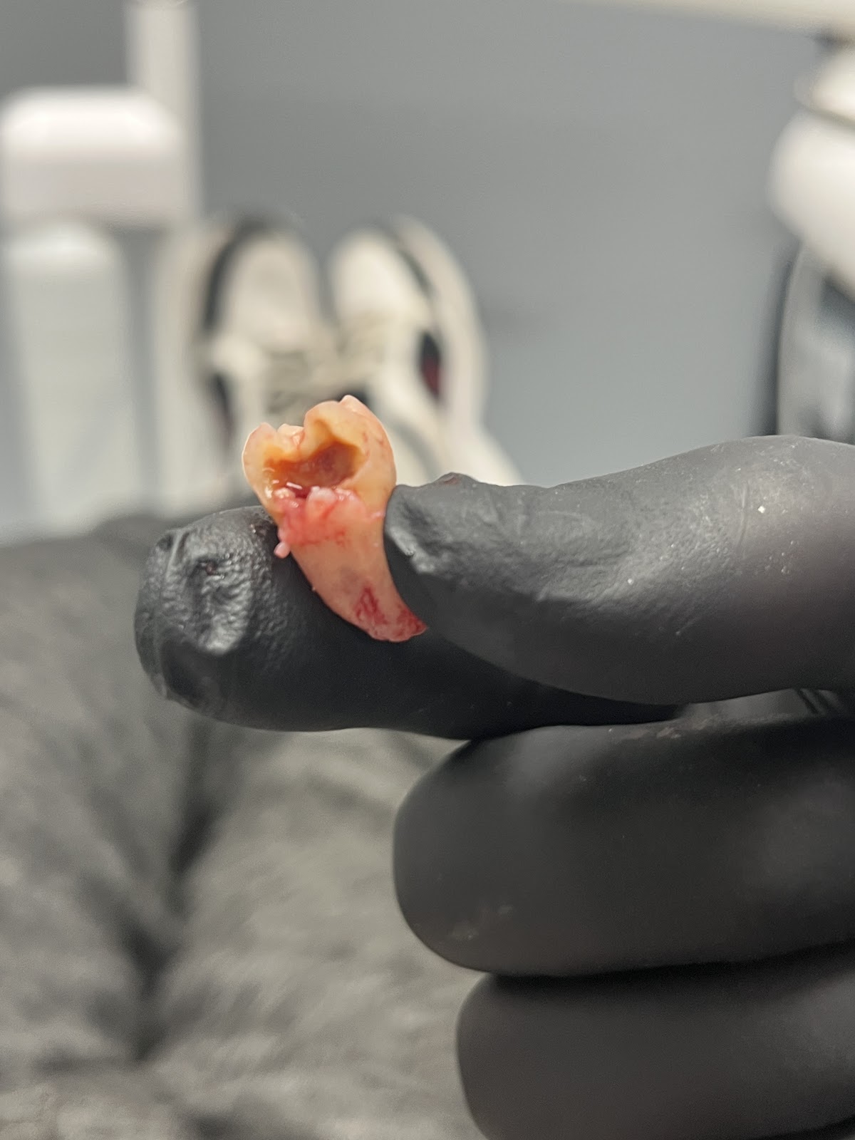 Affordable Dentures & Implants - Wichita photo 6
