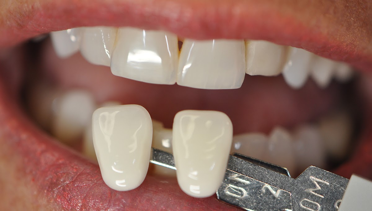 Glodental Lab photo 4