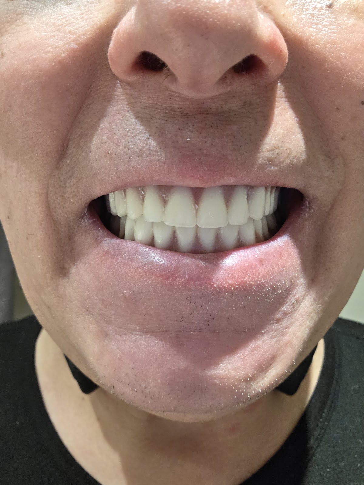 Affordable Dentures & Implants - Panama City photo 6