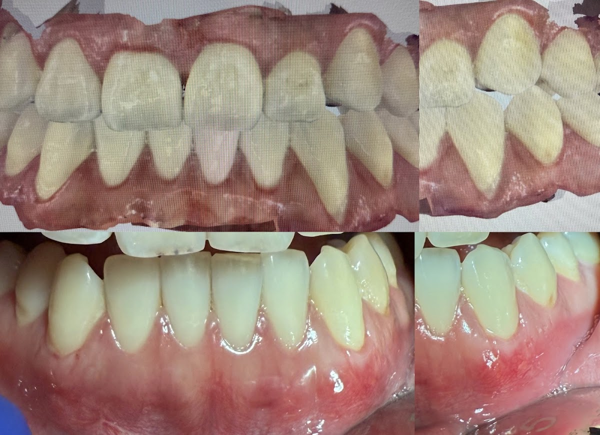 Bay Area Dental & Implant Center photo 5
