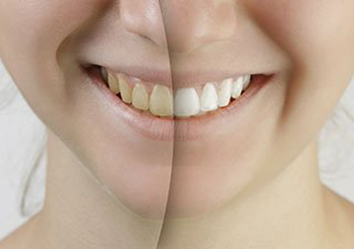 Saratoga Family Dentistry photo 1