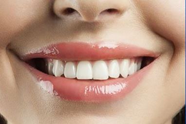 Saratoga Family Dentistry photo 3