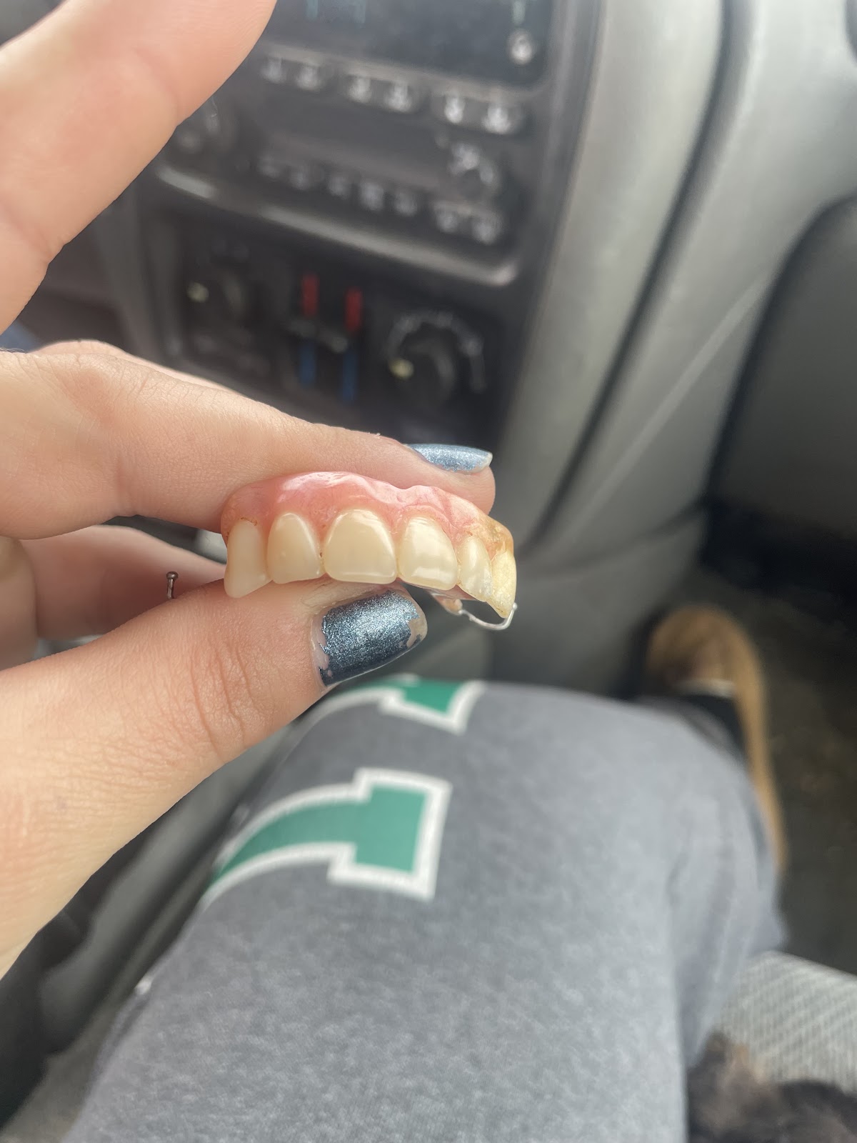 Affordable Dentures & Implants - Shepherdsville photo 2