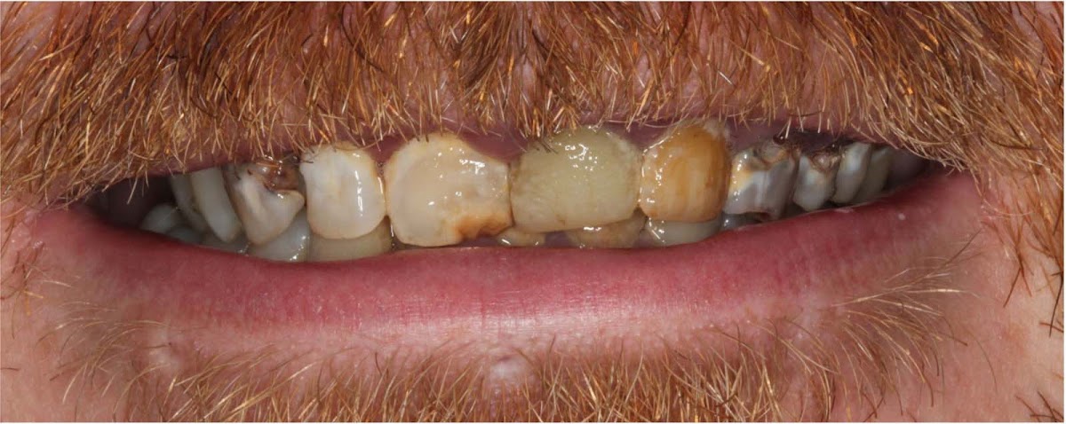 Montana Dental Arts photo 5