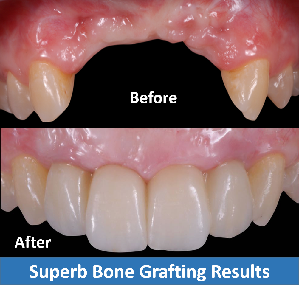 Affordable Dental Implant Excellence photo 4