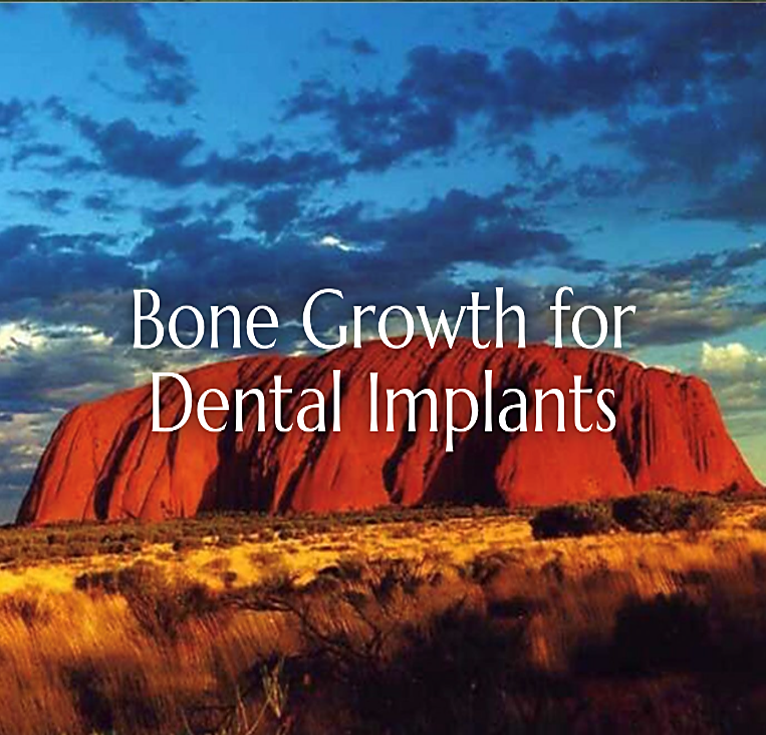Affordable Dental Implant Excellence photo 5